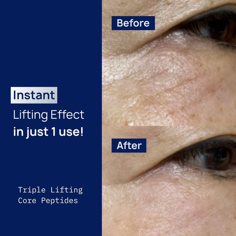 Brand panel: instant lifting effect in one use, with a before and after